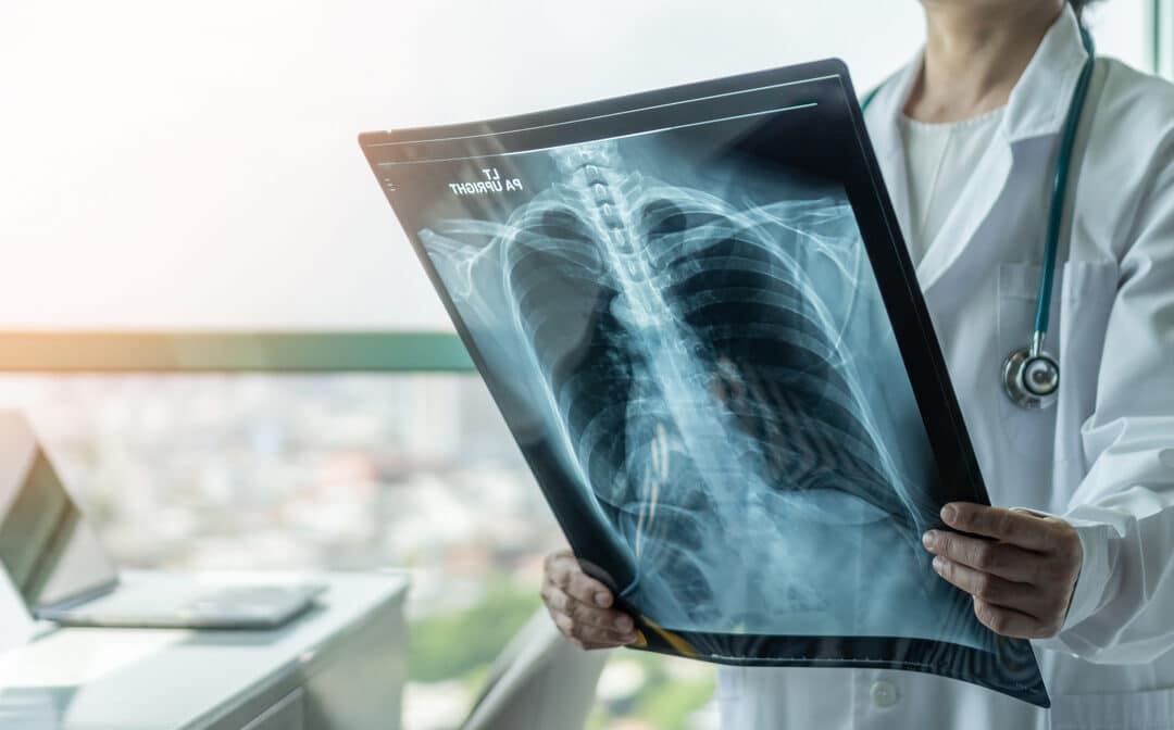 Doctor examining chest X-ray in office.